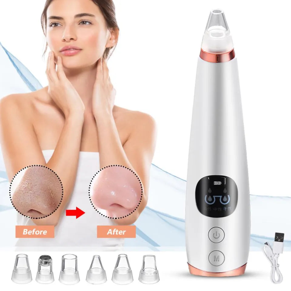 Blackhead Remover Instrument Black Dot Remover Acne Vacuum Suction Face Clean Black Head Pore Cleaning Beauty Skin Care Tool - Black Head Remover - Darma Roller
