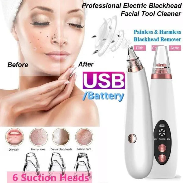Blackhead Remover Instrument Black Dot Remover Acne Vacuum Suction Face Clean Black Head Pore Cleaning Beauty Skin Care Tool - Black Head Remover - Darma Roller