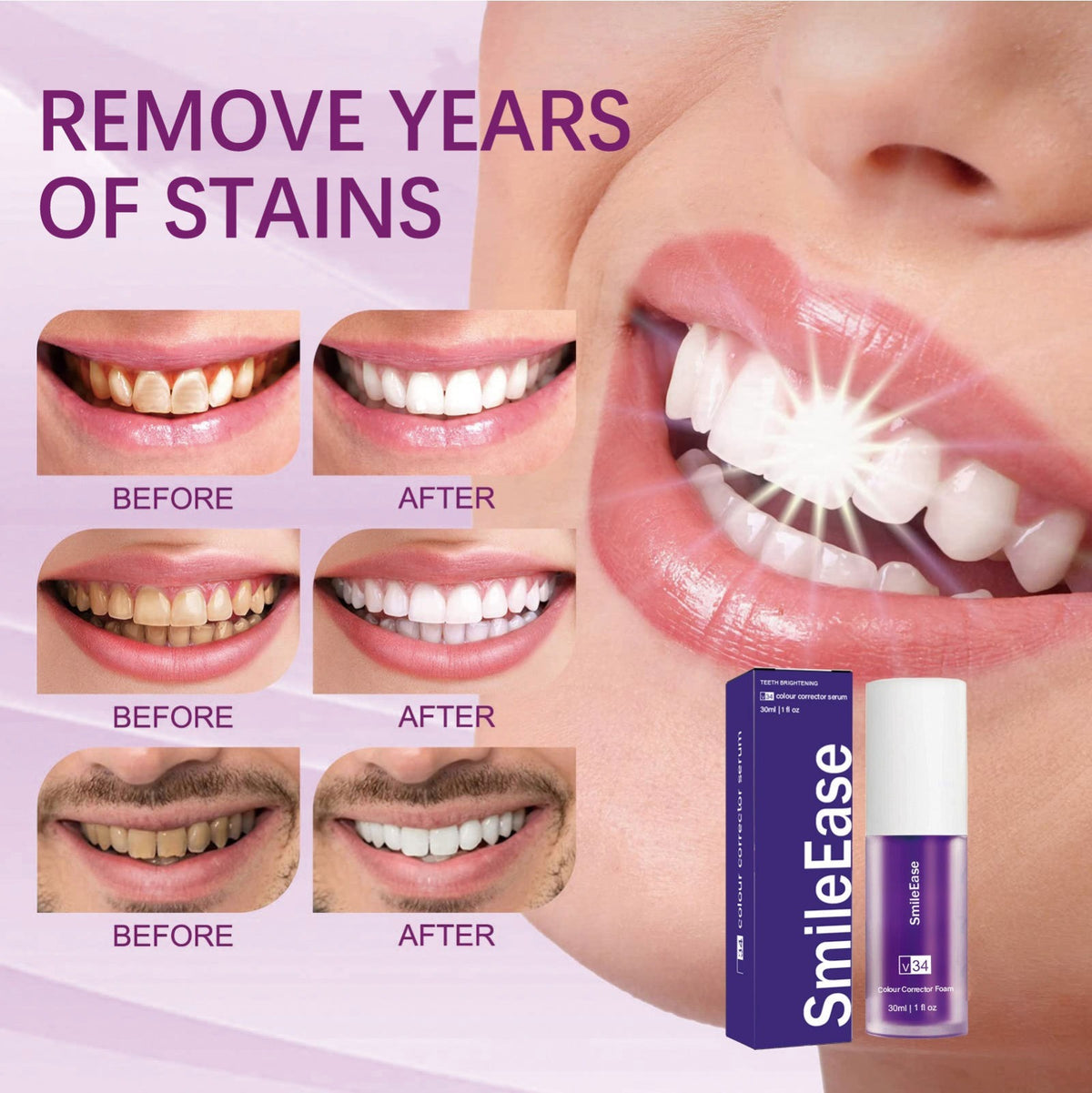 Hismile V34 Colour Corrector Serum (Teeth Whitening/Brightening)
