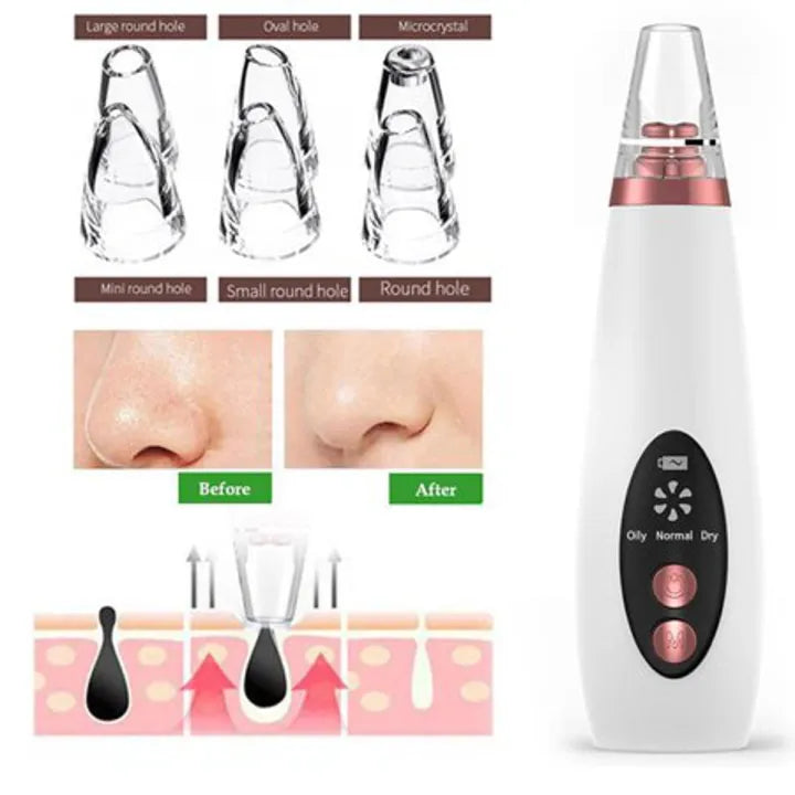 Blackhead Remover Instrument Black Dot Remover Acne Vacuum Suction Face Clean Black Head Pore Cleaning Beauty Skin Care Tool - Black Head Remover - Darma Roller